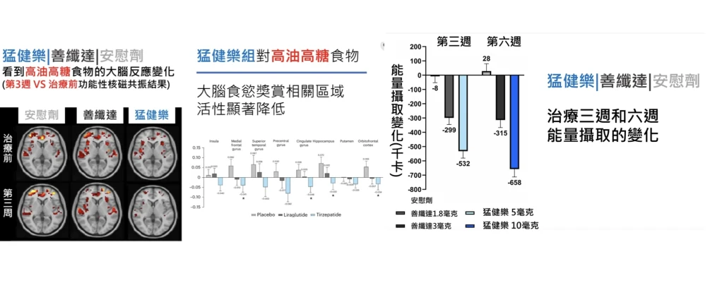 猛健樂不僅抑制食慾,還重新「調校大腦對食物的反應」
